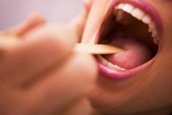Ung thư lưỡi: Nguyên nhân, nhận biết, phòng và điều trị