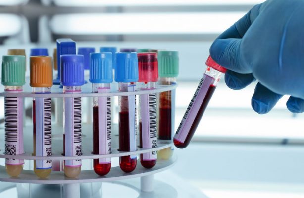 Xét nghiệm máu tổng quát và những điều cần lưu ý - Bệnh viện Ung bướu Nghệ  An